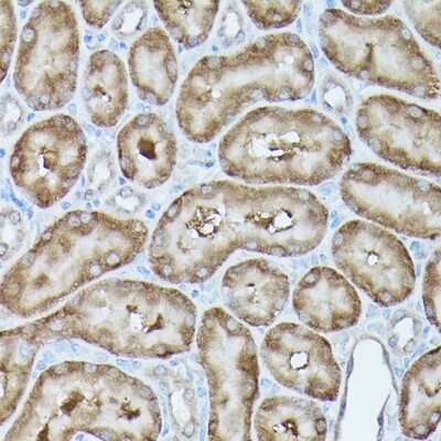Immunohistochemistry-Paraffin: GBL Antibody - Azide and BSA Free [NBP3-03451]