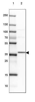 Western Blot: GBL Antibody [NBP2-38491]