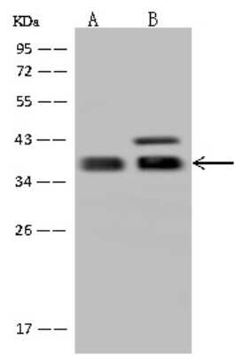 Western Blot: GBL Antibody [NBP2-98484]