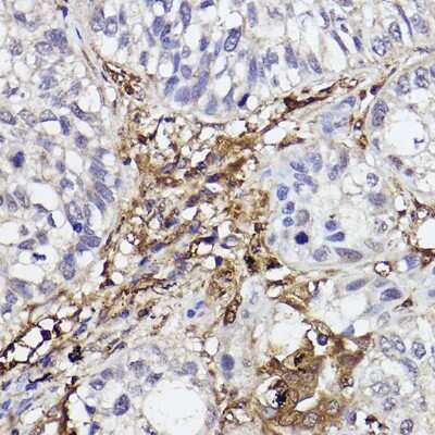 Immunohistochemistry-Paraffin: GBP1 Antibody (3X7O9) [NBP3-15278]