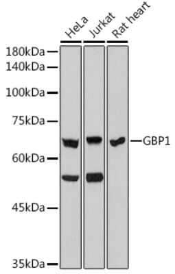 Western Blot: GBP1 Antibody (3X7O9) [NBP3-15278]