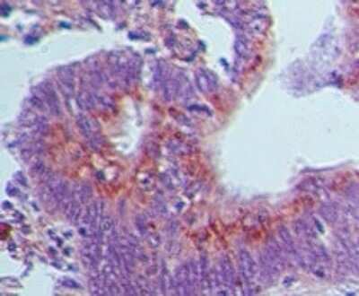 Immunohistochemistry-Paraffin: GBP1 Antibody [NBP2-03972]