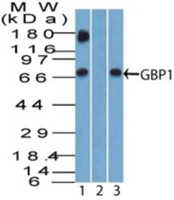 Western Blot: GBP1 Antibody [NBP2-03972]