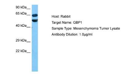 Western Blot: GBP1 Antibody [NBP2-86645]