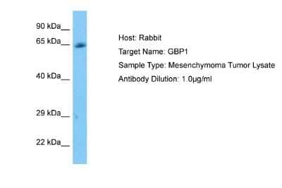 Western Blot: GBP1 Antibody [NBP2-86646]