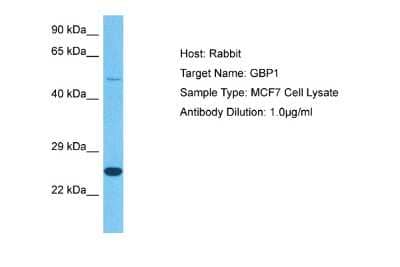 Western Blot: GBP1 Antibody [NBP2-86647]