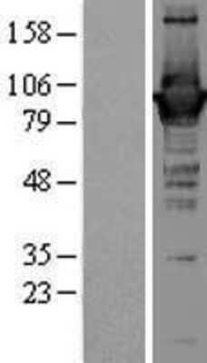 Western Blot: GBP1 Overexpression Lysate [NBL1-10996]