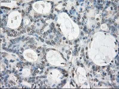 Immunohistochemistry-Paraffin: GBP2 Antibody (OTI5C8) [NBP1-47768]
