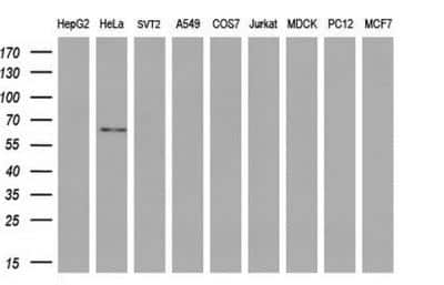 Western Blot: GBP2 Antibody (OTI5C8) [NBP1-47768]