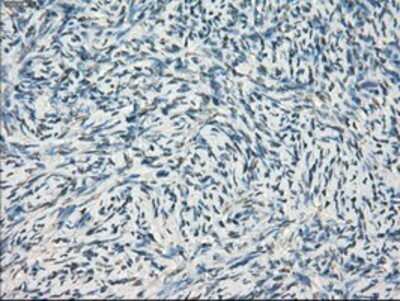 Immunohistochemistry: GBP2 Antibody (OTI5C8) - Azide and BSA Free [NBP2-70812]
