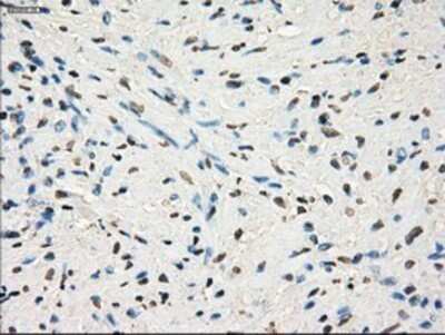 Immunohistochemistry: GBP2 Antibody (OTI5C8) - Azide and BSA Free [NBP2-70812]