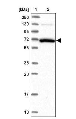 Western Blot: GBP2 Antibody [NBP2-48771]