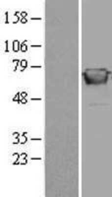 Western Blot: GBP2 Overexpression Lysate [NBL1-10997]