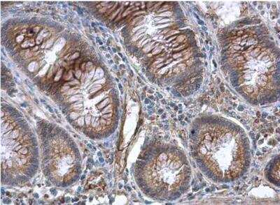Immunohistochemistry-Paraffin: GBP3 Antibody [NBP1-31714]