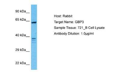 Western Blot: GBP3 Antibody [NBP2-84958]