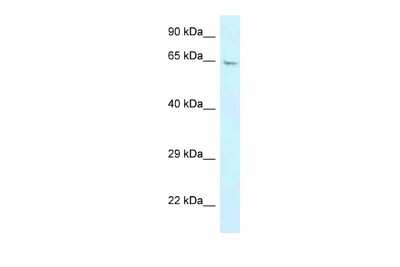 Western Blot: GBP3 Antibody [NBP2-84959]