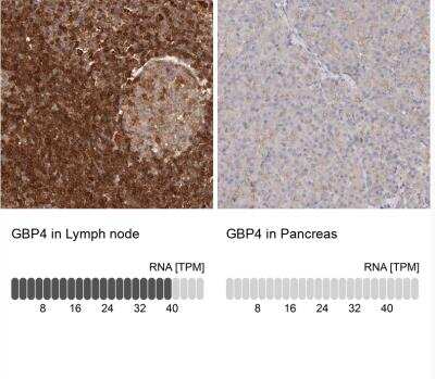 Immunohistochemistry-Paraffin: GBP4 Antibody [NBP1-82628]