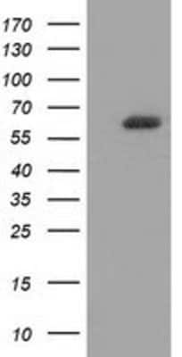 Western Blot: GBP5 Antibody (OTI5C9) [NBP2-03468]