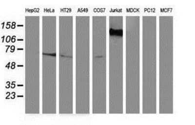 Western Blot: GBP5 Antibody (OTI5C9) [NBP2-03468]