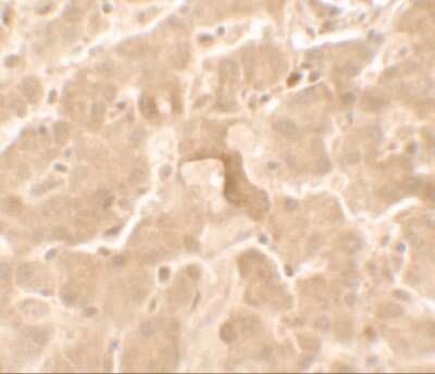 Immunohistochemistry: GBP5 Antibody - BSA Free [NBP2-81821]