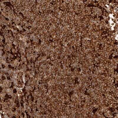 Immunohistochemistry-Paraffin: GBP5 Antibody [NBP1-85947]
