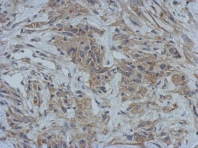 Immunohistochemistry-Paraffin: GBP5 Antibody [NBP2-16620]