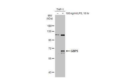 Western Blot: GBP5 Antibody [NBP1-32520]