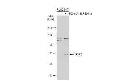 Western Blot: GBP5 Antibody [NBP1-32520]