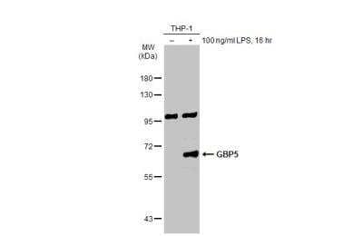 Western Blot: GBP5 Antibody [NBP2-16620]