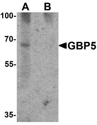 Western Blot: GBP5 AntibodyBSA Free [NBP2-81821]