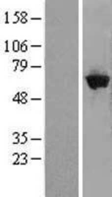 Western Blot: GBP5 Overexpression Lysate [NBL1-10998]