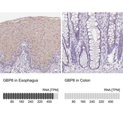 Immunohistochemistry-Paraffin: GBP6 Antibody [NBP1-84117]