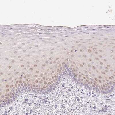 Immunohistochemistry-Paraffin: GBP6 Antibody [NBP1-84117]