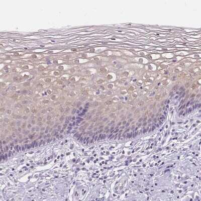 Immunohistochemistry-Paraffin: GBP6 Antibody [NBP1-84117]