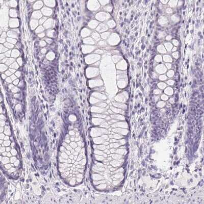 Immunohistochemistry-Paraffin: GBP6 Antibody [NBP1-84117]