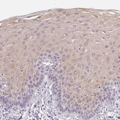 Immunohistochemistry-Paraffin: GBP6 Antibody [NBP1-84117]