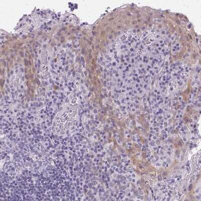 Immunohistochemistry-Paraffin: GBP6 Antibody [NBP1-84117]