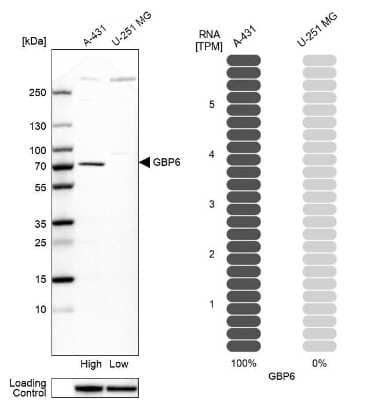 Western Blot: GBP6 Antibody [NBP1-84117]