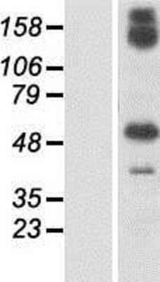 Western Blot: GBP6 Overexpression Lysate [NBP2-04704]