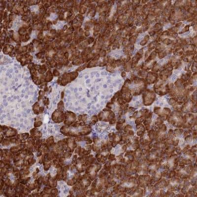 Immunohistochemistry-Paraffin: GBP7 Antibody [NBP2-14731]