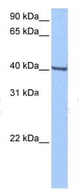 Western Blot: GBX1 Antibody [NBP1-91420]