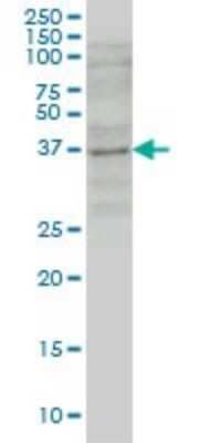 Western Blot: GBX2 Antibody (1A7) [H00002637-M03]