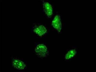 Immunocytochemistry/ Immunofluorescence: GBX2 Antibody (1C11) [H00002637-M04]