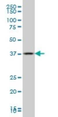 Western Blot: GBX2 Antibody (2A4) [H00002637-M01]