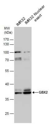 Western Blot: GBX2 Antibody [NBP2-43617]