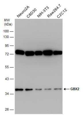 Western Blot: GBX2 Antibody [NBP2-43617]