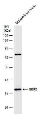 Western Blot: GBX2 Antibody [NBP2-43617]