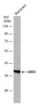 Western Blot: GBX2 Antibody [NBP2-43617]