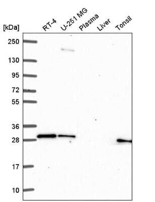 Western Blot: GBX2 Antibody [NBP2-56315]