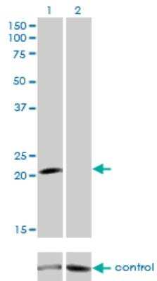 Western Blot: GCAP1 Antibody (2F7) [H00002978-M04]